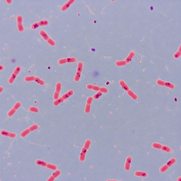 Micrografía óptica de Salmonella tiphy