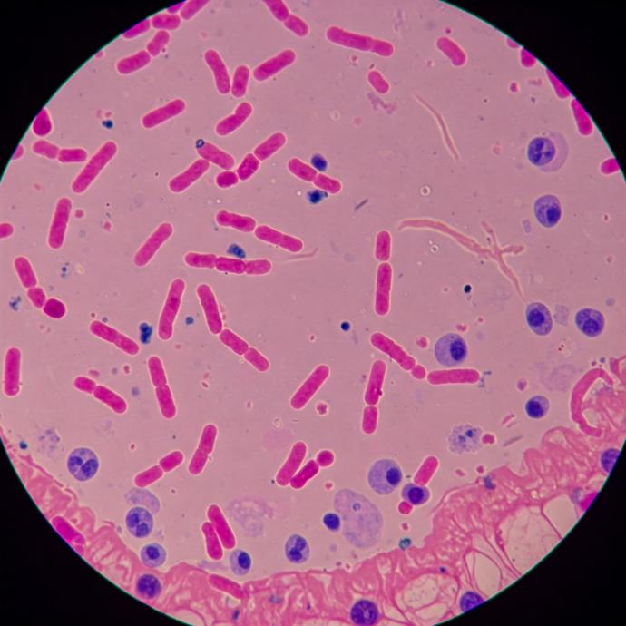 Micrografía optica de E. Coli